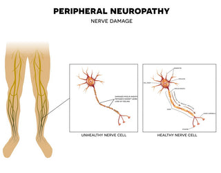 Lion’s Mane Mushroom For Neuropathy and Nerve Support